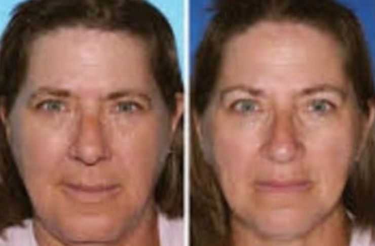 スモーカーズフェイス2【ブドワールログ】