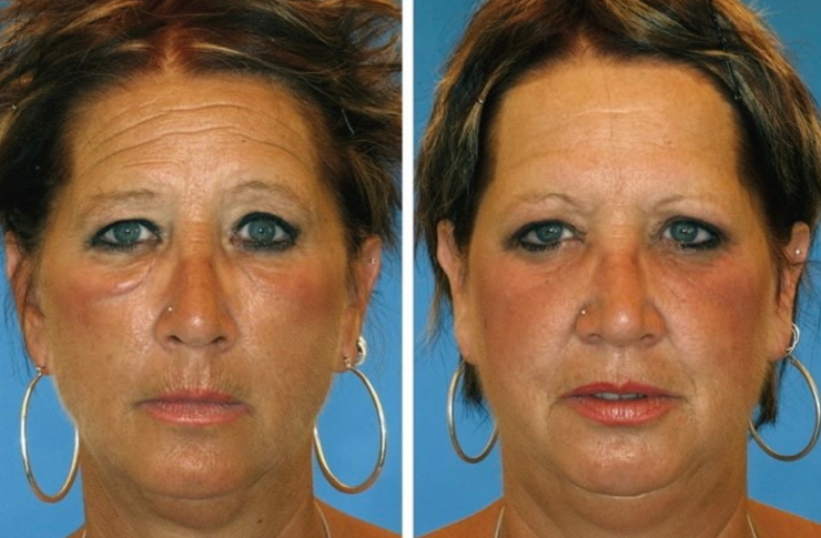 スモーカーズフェイス3【ブドワールログ】